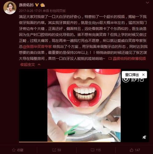明星网红同款美牙,明星同款笑容养成记
